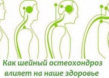 Как уберечься от шейного остеохондроза и как он влияет на наше состояние