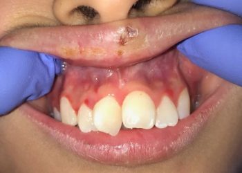 Быстрая диагностика 1.2